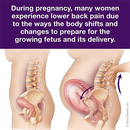 Pregnancy Pain.