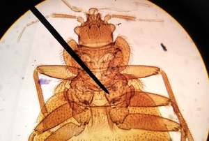 bedbug under microscope