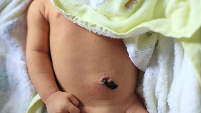 Baby with umbilical cord
