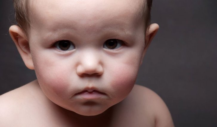 atlanta aging anti be Can Prevented? Birthmarks