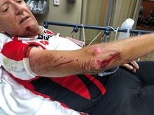 Right elbow pretty sad looking