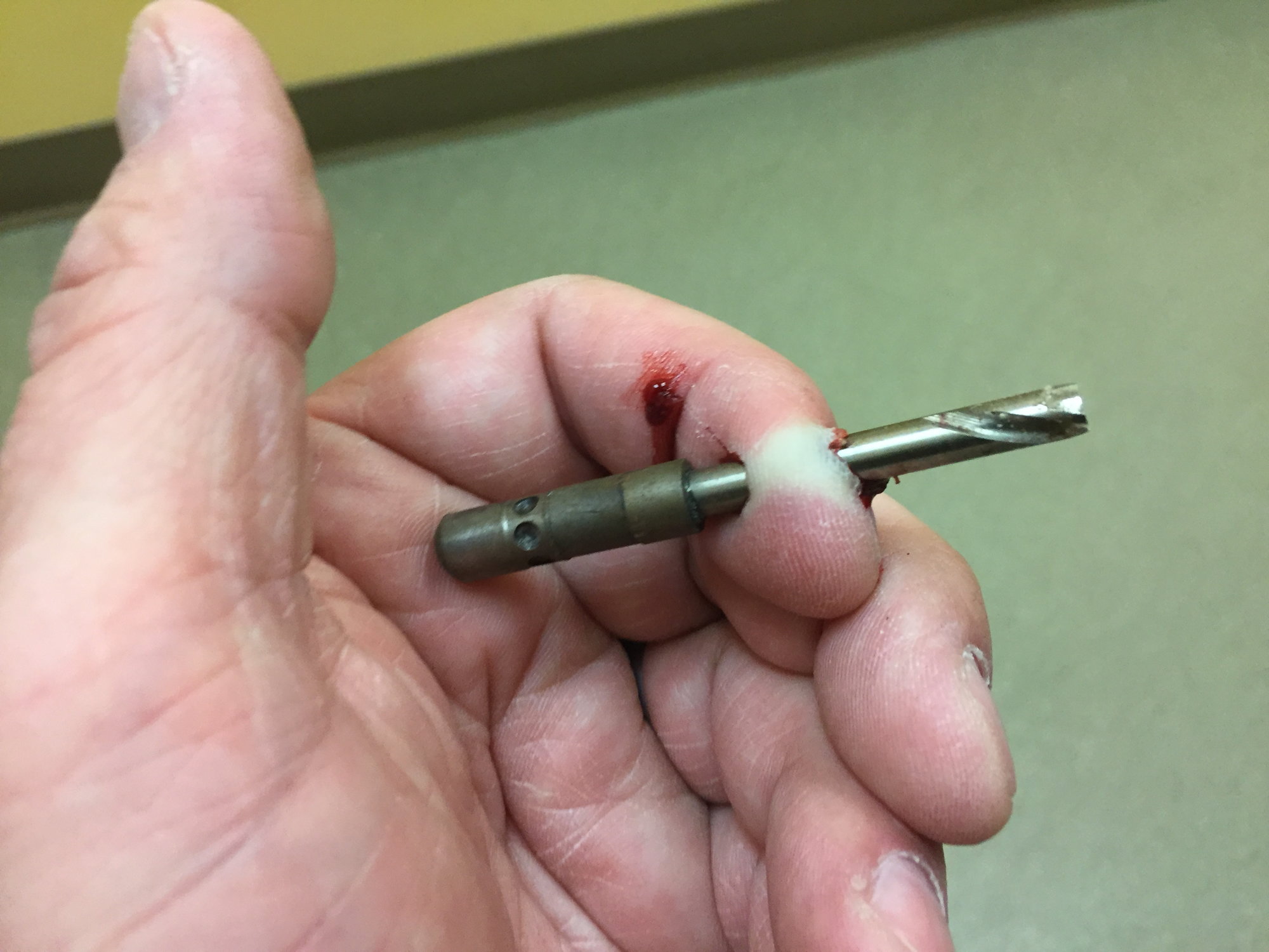 Ot So I Drilled A Hole In My Finger Today Page 2 Ford Truck Enthusiasts Forums