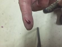 ouch