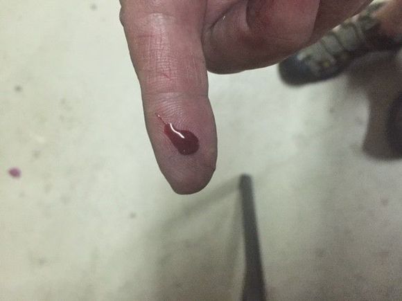 ouch
