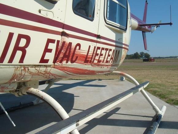 a very bad trauma flight