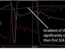 Second 3rd and partial 4th pull (ran out of road) straight after hard brake from first pull. Compare the IAT/MAT gain.
