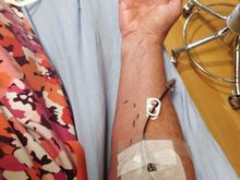 ^ That hurt, the needle for the IV!  The nurse put the dash line around the red swollen skin so I can see if it gets worse.