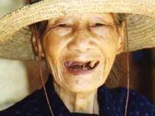 teeth.jpg