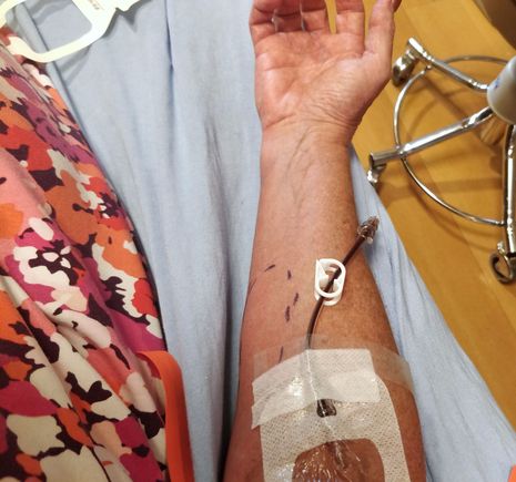 ^ That hurt, the needle for the IV!  The nurse put the dash line around the red swollen skin so I can see if it gets worse.