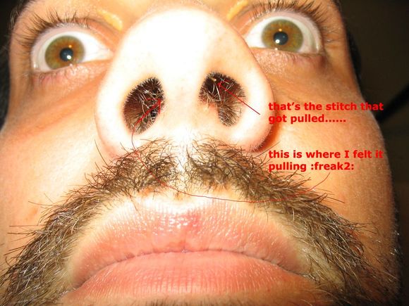 nose2.jpg